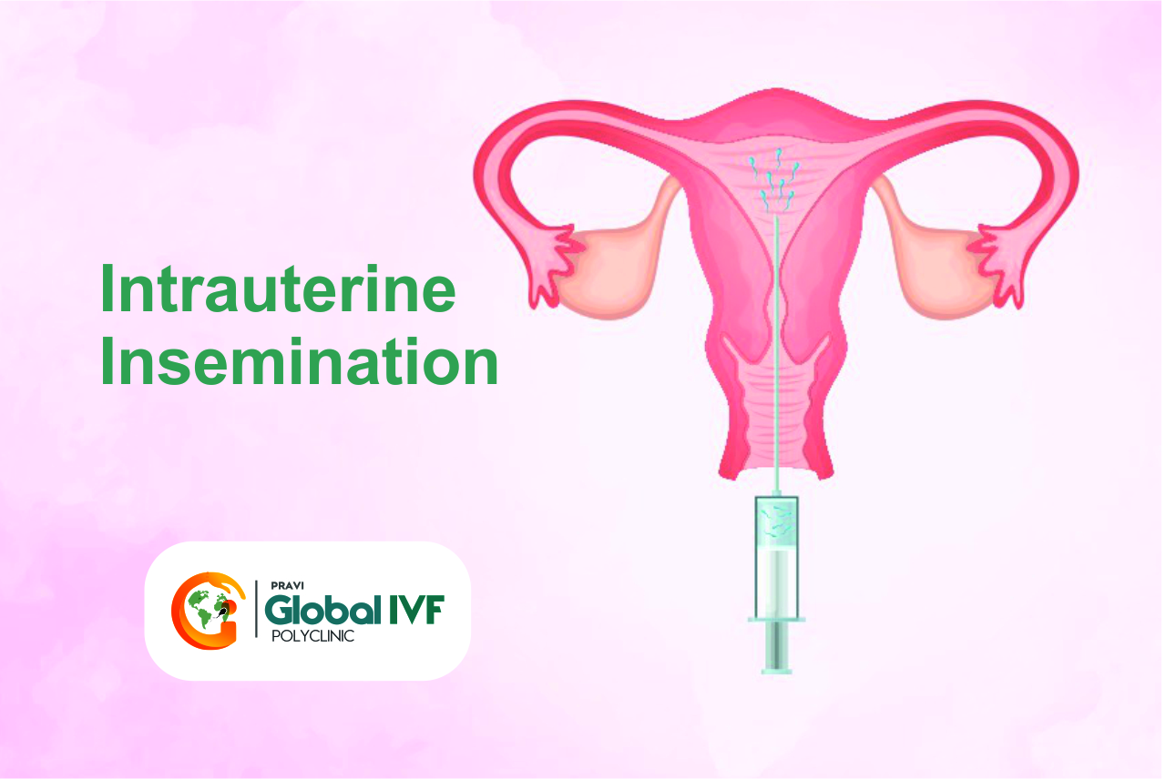 IUI