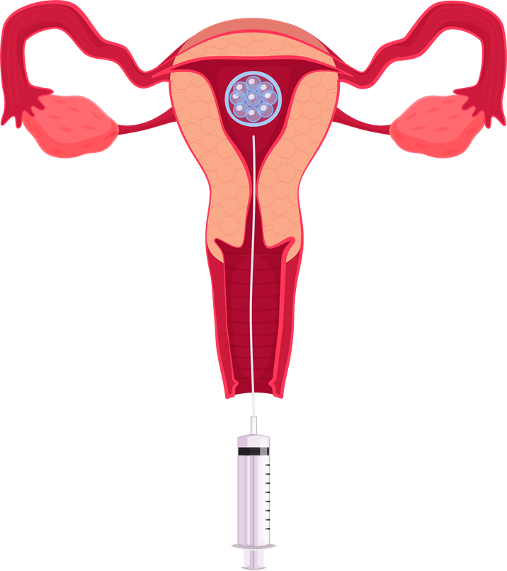 Medical procedure