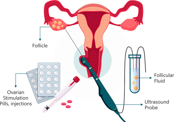 Medical procedure